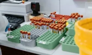Lo ngại về vụ thất lạc 300 lọ chứa virus nguy hiểm ở Australia Lo ngại về vụ thất lạc 300 lọ chứa virus nguy hiểm ở Australia